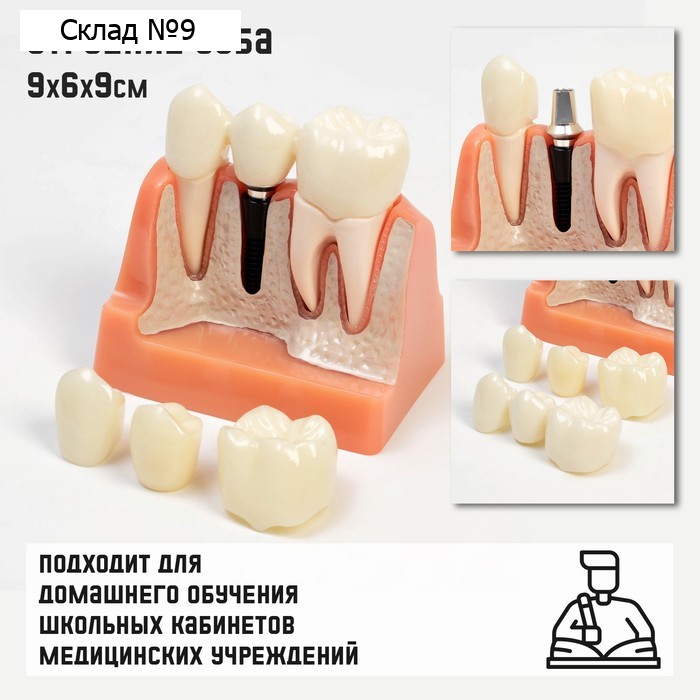 Анатомическая модель «Макет строения зуба», 9×6×9 см