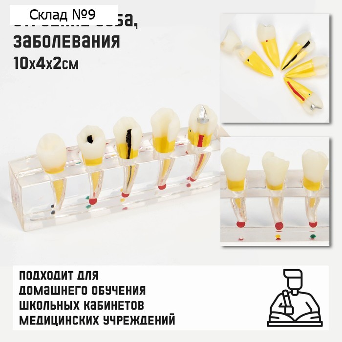 Анатомическая модель «Макет зуба с патологиями», 10×4×2 см